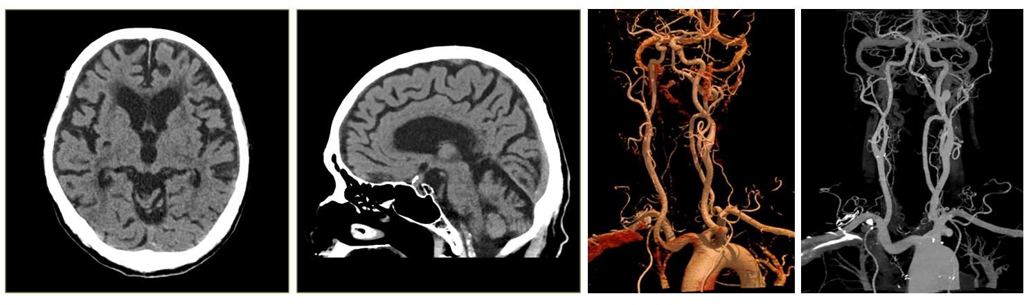 스크린샷 2026-02-11 163745.png